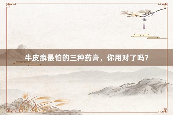 牛皮癣最怕的三种药膏，你用对了吗？